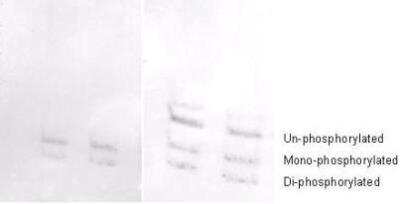 Western Blot: MRCL3 [p Ser19, p Ser20] Antibody [NB100-1687]